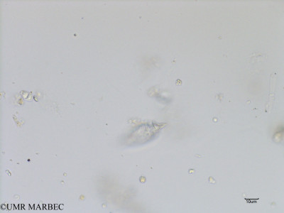 phyto/Bizerte/bizerte_bay/RISCO July 2016/Oxytoxum challengeroides (Baie_T1C-Oxytoxum challengeroides -2).tif(copy)_thumb.jpg